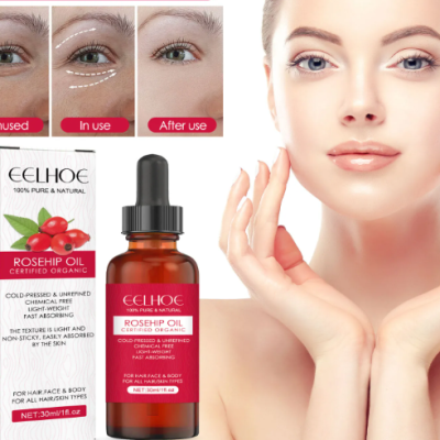 EELHOE Rosehip Facial Oil bottle